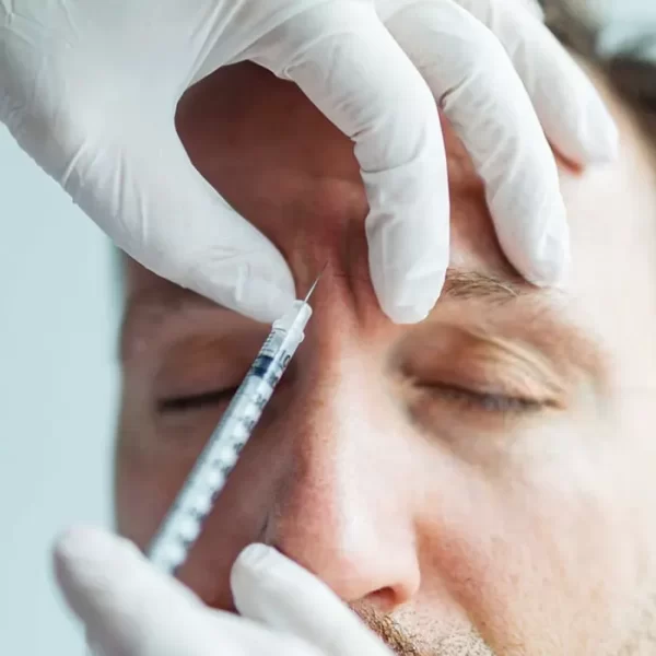 Bótox en el entrecejo