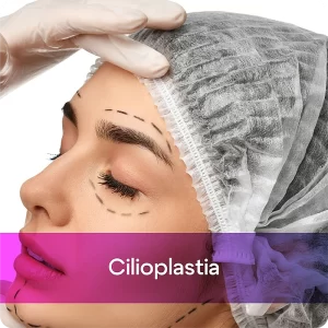 cilioplastia