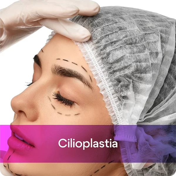 Cilioplastia