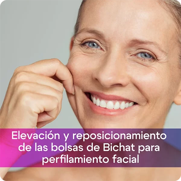 Elevación y reposicionamiento de las bolsas de Bichat