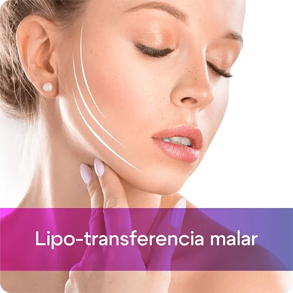 Lipo-transferencia malar
