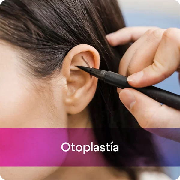 otoplastia@riomedic&egospa